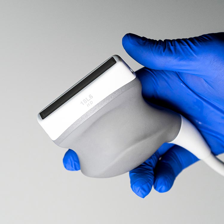 Reparierte Ultraschallsonde in Hand