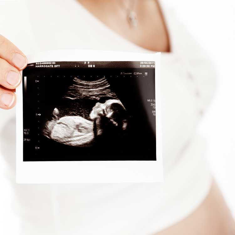 Ultraschall als „Babyfernsehen“ wird verboten